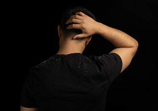 Best Dandruff Treatments Explained: Choosing the Right Shampoos and Ingredients for Your Scalp