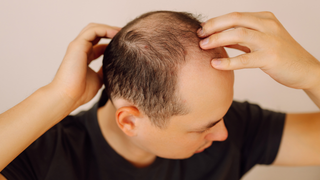 Itchy Scalp and Hair Loss: Why They Can Happen Together and When to Seek Help