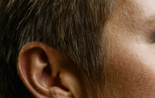 Micro shot of mans hair and scalp
