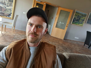 “It spread from my scalp to my face and beard” – The common condition millions of Brits silently struggle with