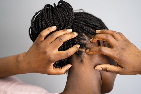 What causes an itchy scalp?
