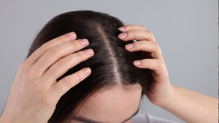 Why Does My Scalp Feel Like It's Burning? Common Causes, Relief and When to Seek Help