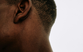 Close up image of male scalp