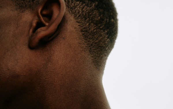 Close up image of male scalp