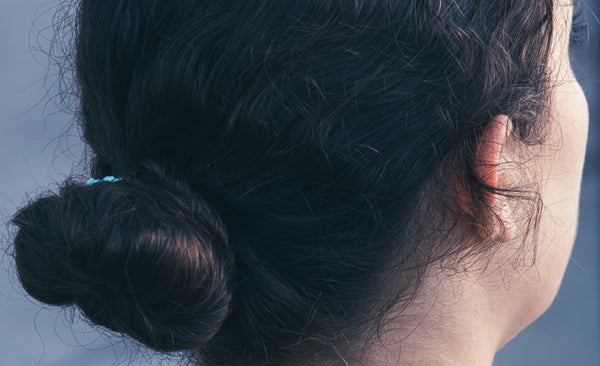Can Scalp Psoriasis Go Away? What the Experts Say